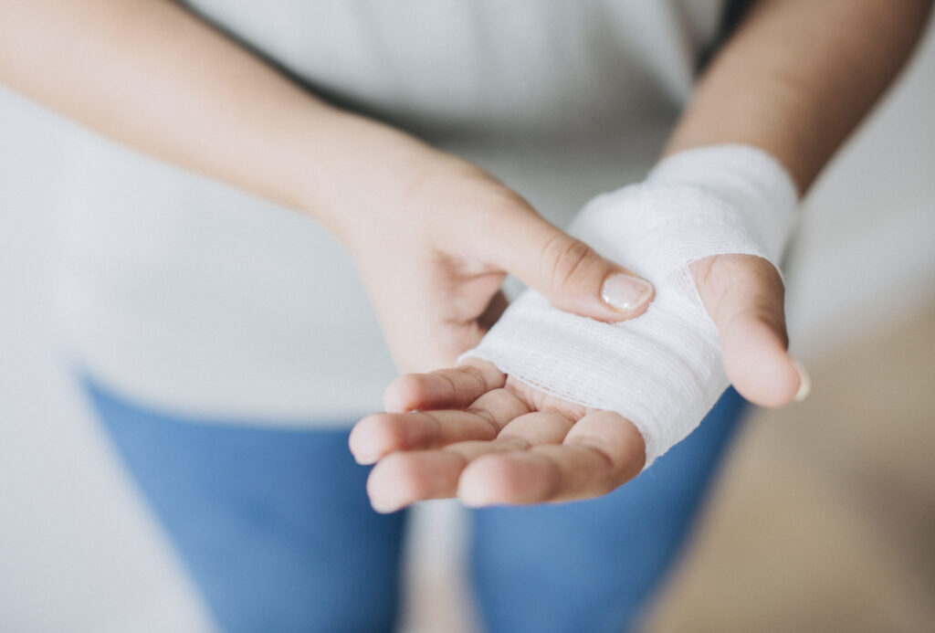 woman-with-gauze-bandage-wrapped-around-her-hand